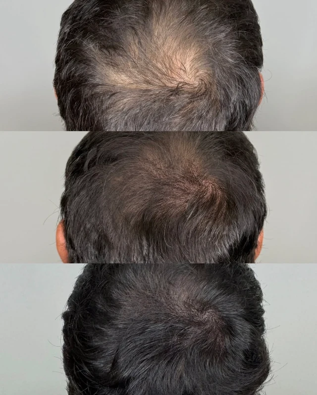 Slavic Capsule hair result 6
